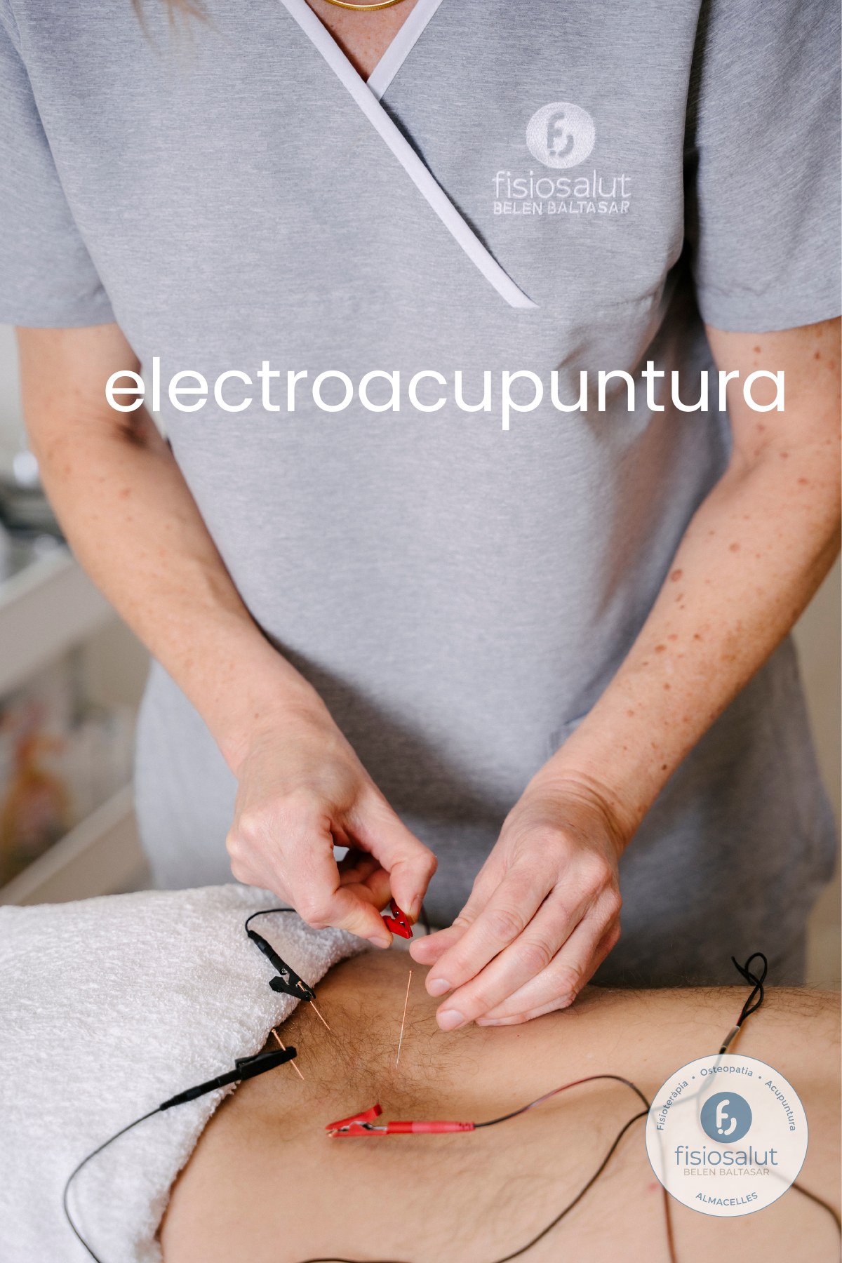 Electroacupuntura
